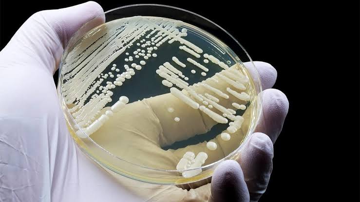 Drug-resistant fungus spreads to 23 states including Wisconsin