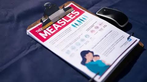 US sees highest number of measles cases in 35 years