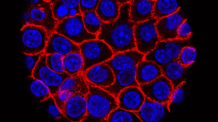 Georgia hospitals test ‘game-changer’ pancreatic cancer drugs