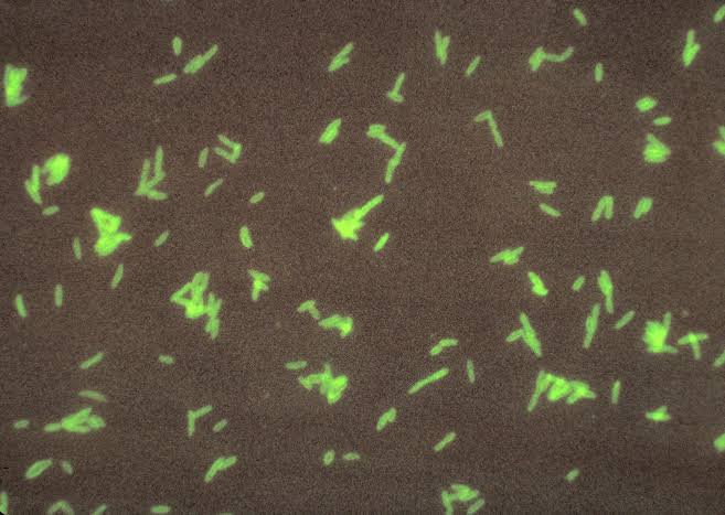 Legionnaires’ Outbreak Turns Deadly on New York’s Upper East Side