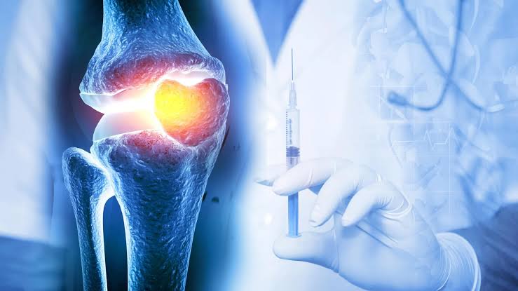 One injection reversed osteoarthritis in weeks