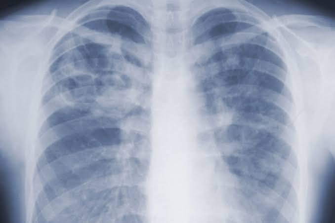 'Kind of the first time we've had an estimate like this': first CDC study on mold finds it's much deadlier than we thought