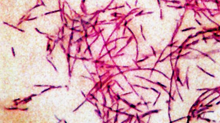 Source of exposure for Legionnaires' disease cluster in New York City 'eliminated': Health officials