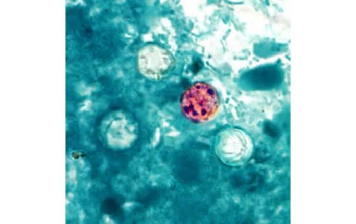 Health Department confirms 4th case of cyclosporiasis in Hawaii