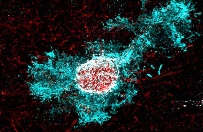 How stress hormone shapes brain development: New clues to why early plasticity fades