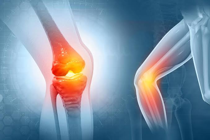 New Treatment Could Reverse Osteoarthritis Within Weeks
