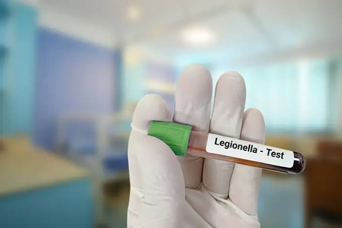 Number of UES buildings with positive Legionella tests more than doubles since preliminary findings