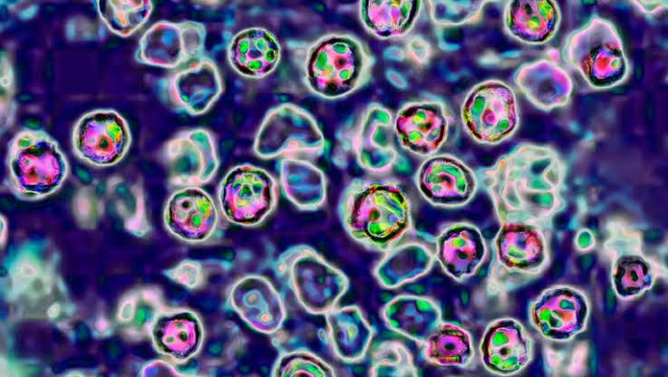 2 more measles cases confirmed in Maryland, bringing total to 11