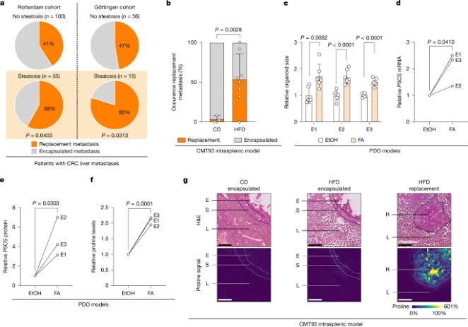 Steatosis shapes prognosis-defining liver metastasis heterogeneity in CRC