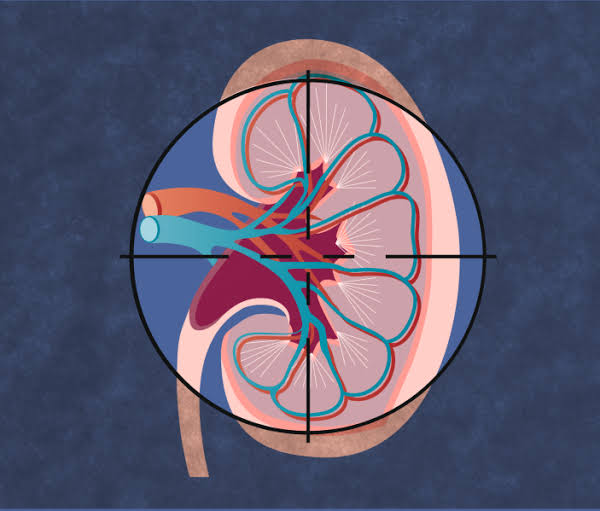Benefits of finerenone treatment across chronic kidney disease aetiologies