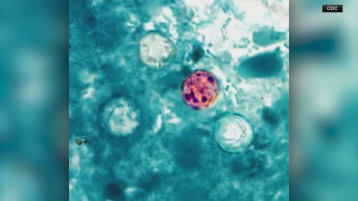 Cyclosporiasis outbreak continues to grow in our area, across the country