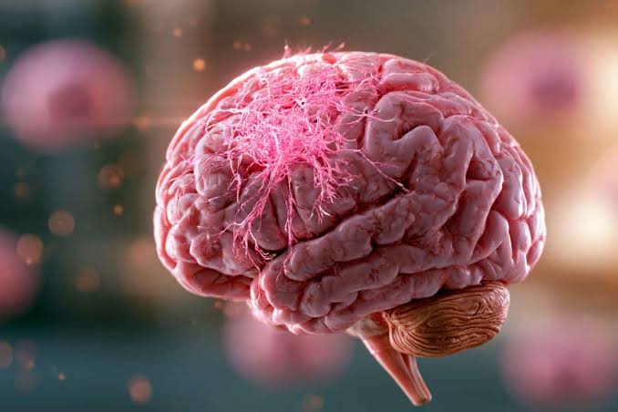 GABA Immune Pathway Drives Female Brain Cancer Growth