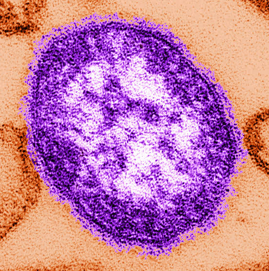 Measles has reached a Portland school. Here’s why health officials think they can stop it