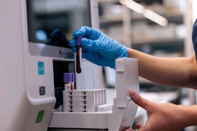 The sneaky kind of cholesterol that may be threatening your heart health