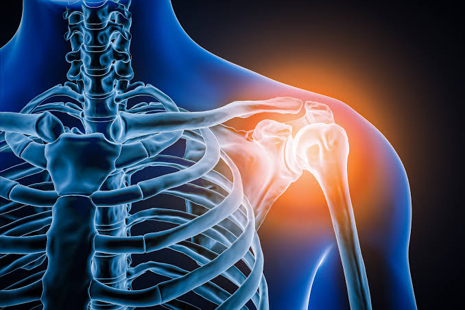 Doctors took a look at man’s painful shoulder—they found the joint was missing