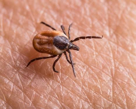 Tick bites are on the rise in the US and UK. Here’s how to protect yourself