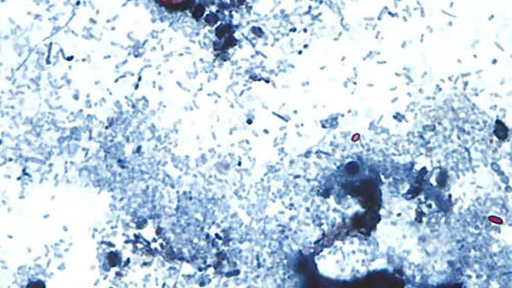 Nearly 600 cases of Cyclosporiasis reported in Michigan on Fourth of July, MDHHS confirms