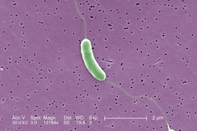 What to Know About the ‘Flesh-Eating’ Bacteria That Killed Someone in Florida