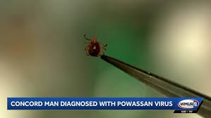 New Hampshire man hospitalized for weeks after contracting tick-borne illness