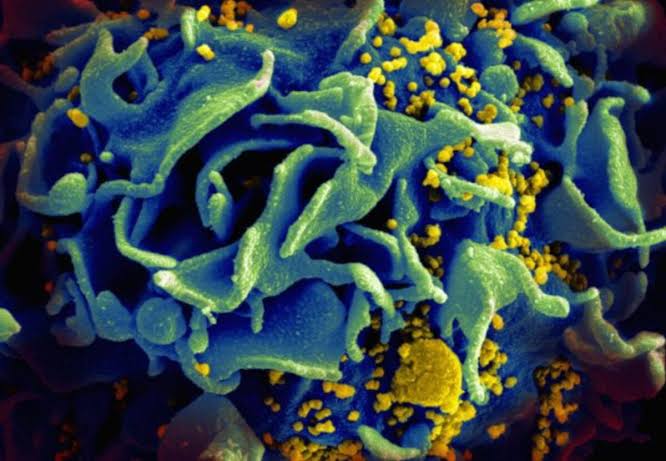 Man ‘cured’ of HIV after brother found to carry rare genetic mutation: ‘Like winning lottery twice’