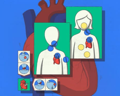 I work in a hospital – and didn’t know I was having a heart attack. Here’s what more women should know