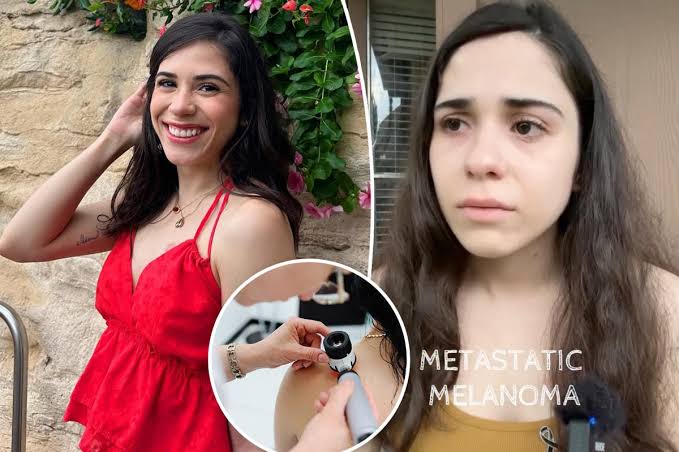 26-year-old shared dire warning — just 3 months before dying of melanoma: ‘This could have been caught earlier’