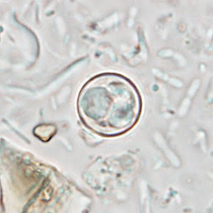 Parasite that causes ‘explosive diarrhea’ is spreading across the US