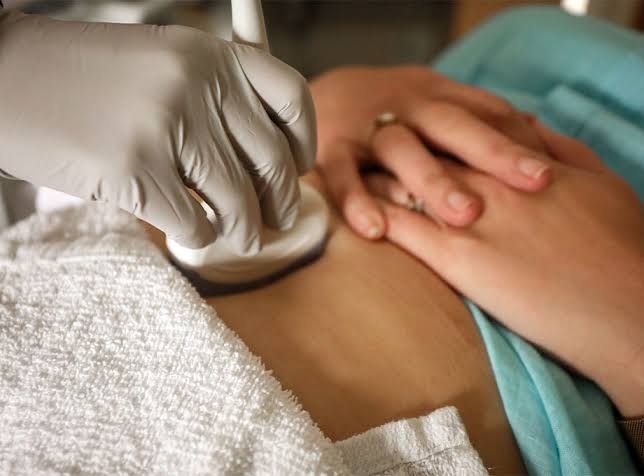 Abortion bans lead to worse outcomes for miscarriages