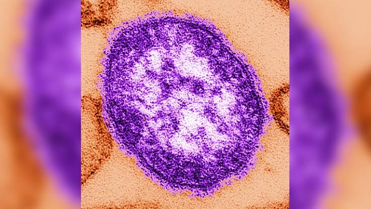 Measles: Multiple new cases reported in Maricopa County