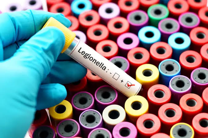 Legionnaires cluster emerging on Upper East Side, NYC officials say