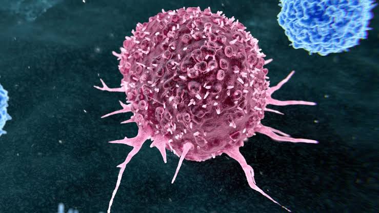 Almost 50% of Preventable Cancers Linked to Just Two Lifestyle Habits