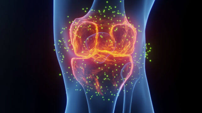 The Best Medicine For Joint Pain Isn't What You Think, Experts Say