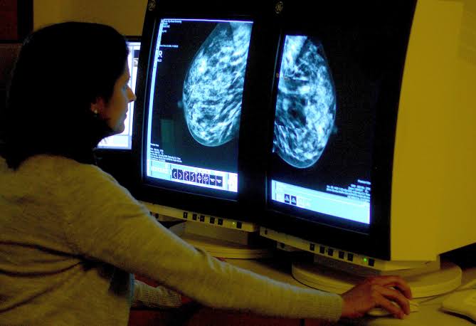 Millions of breast cancer patients could avoid chemotherapy with new genome test