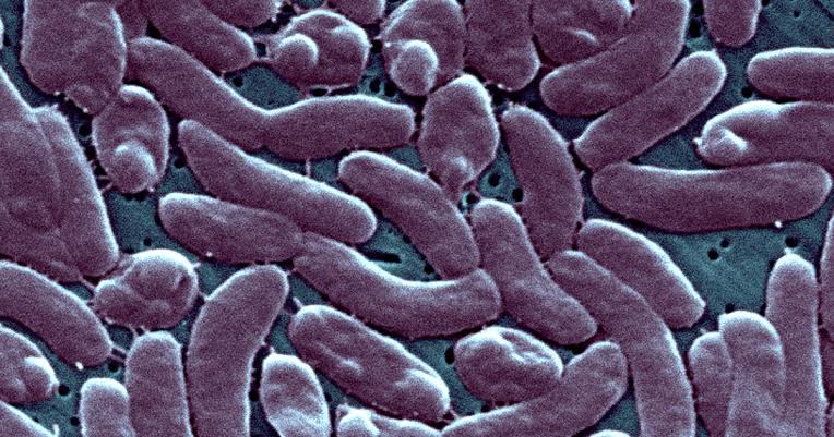 Flesh-eating bacteria kill at least 7 along Gulf Coast. Here's how to protect yourself.