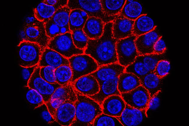 New drug nearly doubles survival rates in some pancreatic cancer patients, study says