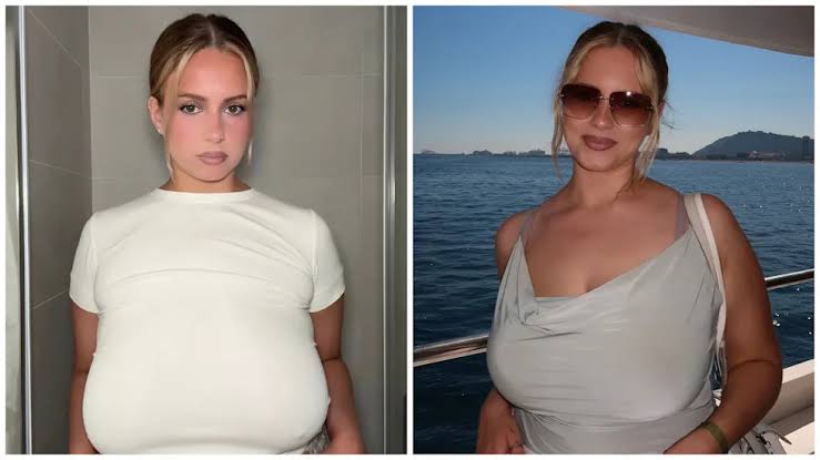 Woman Gets Life-Changing Breast Reduction From Size 36G to 36C