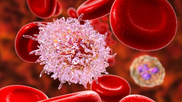 Not every cancer begins with pain: Doctors reveal the everyday symptoms people often ignore for too long