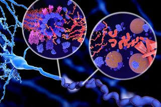 A Common Brain Protein May Help Alzheimer’s Disease Spread — and Understanding This Could Lead to New Treatments