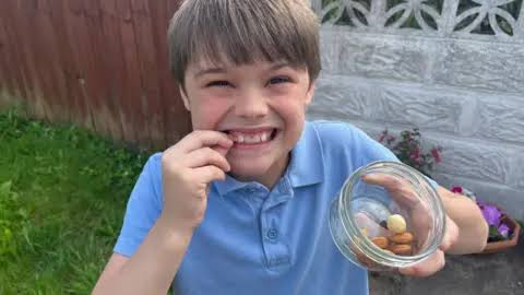 Anaphylaxis concerns for Cardiff boy, 10, with 20 allergies