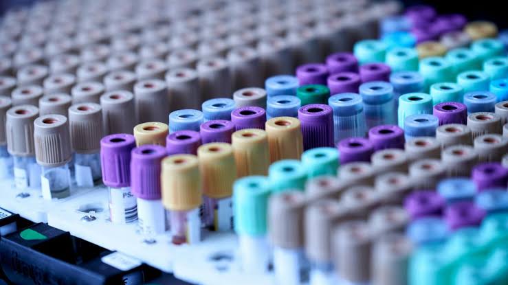 What Blood Tests Could Mean for Early Alzheimer’s Detection