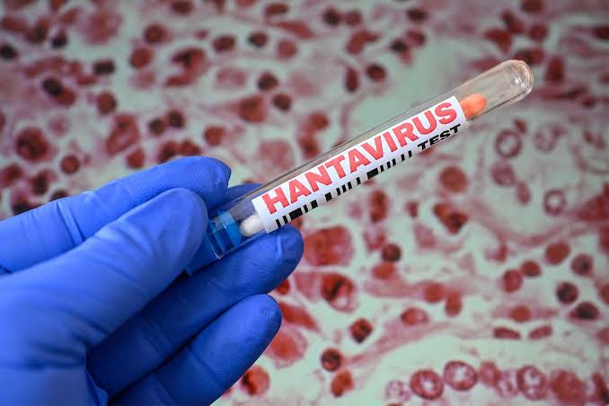 CDC Shares Update on Hantavirus Outbreak in the U.S. After Latest Round of Testing. Here’s What to Know