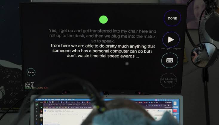 AI and brain-computer interface allow speechless ALS patient to work a full-time job