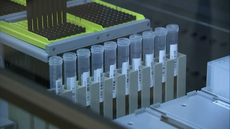 Rotavirus, stomach flu, levels rising across Bay Area: Here's how it spreads, who's most at risk