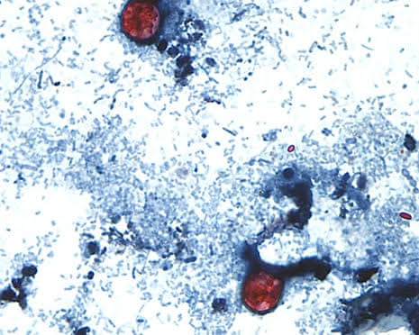 Michigan health officials identify ‘potential source’ of parasite outbreak