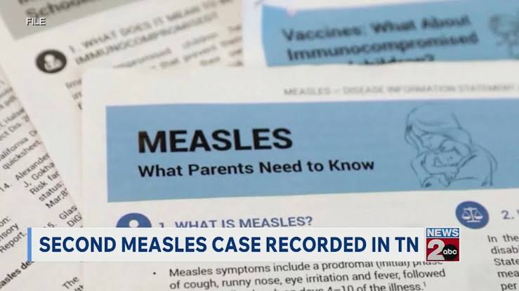 Second measles case of 2026 recorded in Tennessee