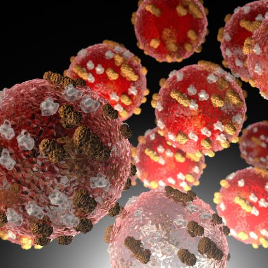 Public Health Confirms Local Measles Case, Public Exposures Identified