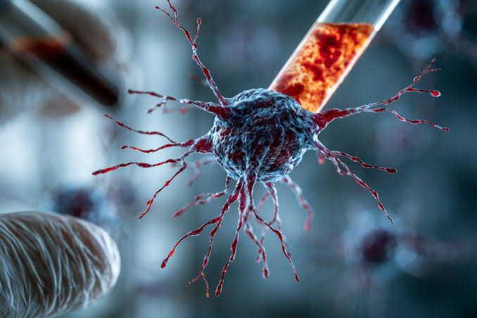 Blood Test Accurately Predicts Five-Year Alzheimer’s Risk