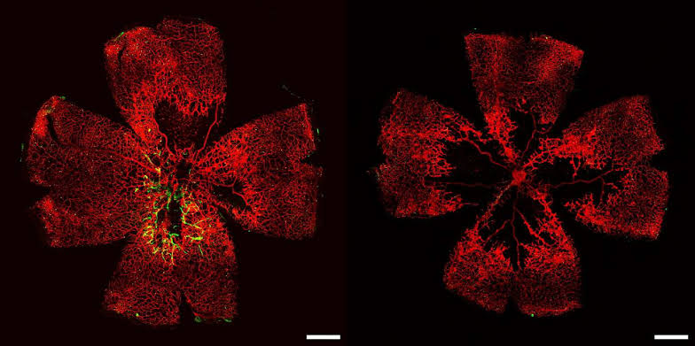 Blind People Offered Hope of Seeing Again After Stem Cell Breakthrough Remakes Retinal Blood Vessels
