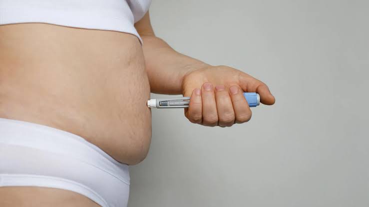 People taking GLP-1 weight loss drugs like Ozempic started moving less