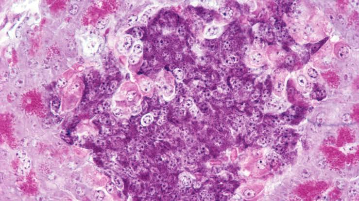 Scientists cured type 1 diabetes in mice by creating a blended immune system